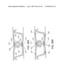 Closure Device Providing Visual Confirmation of Occlusion diagram and image