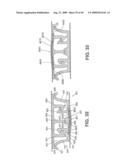 Closure Device Providing Visual Confirmation of Occlusion diagram and image