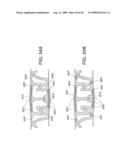 Closure Device Providing Visual Confirmation of Occlusion diagram and image