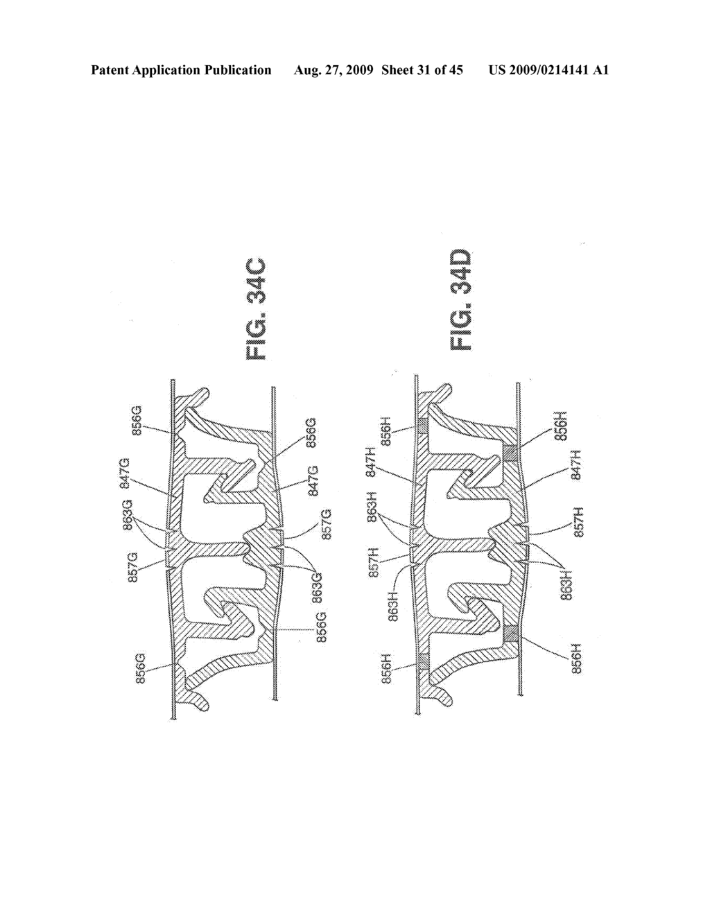 Closure Device Providing Visual Confirmation of Occlusion - diagram, schematic, and image 32