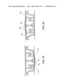 Closure Device Providing Visual Confirmation of Occlusion diagram and image