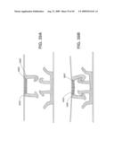 Closure Device Providing Visual Confirmation of Occlusion diagram and image