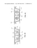 Closure Device Providing Visual Confirmation of Occlusion diagram and image