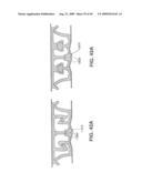 Closure Device Providing Visual Confirmation of Occlusion diagram and image