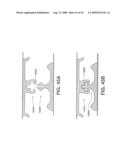 Closure Device Providing Visual Confirmation of Occlusion diagram and image