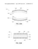 Closure Device Providing Visual Confirmation of Occlusion diagram and image