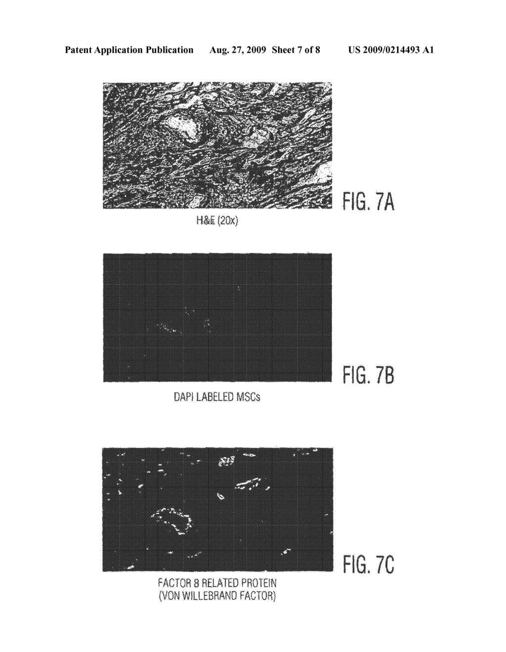 Cardiac Muscle Regeneration Using Mesenchymal Stem Cells - diagram, schematic, and image 08