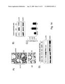 Antigenic Epitopes Of Inteleukin-21, Related Antibodies And Their Use In Medical Field diagram and image