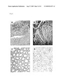 COLON CANCER RELATED GENE TOM34 diagram and image