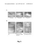 BIOMATERIALS HAVING NANOSCALE LAYERS AND COATINGS diagram and image