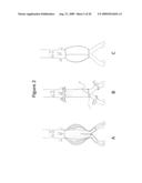 TREATMENT OF ANEURYSM WITH APPLICATION OF CONNECTIVE TISSUE STABILIZATION AGENT IN COMBINATION WITH A DELIVERY VEHICLE diagram and image