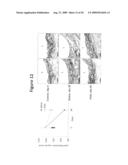 TREATMENT OF ANEURYSM WITH APPLICATION OF CONNECTIVE TISSUE STABILIZATION AGENT IN COMBINATION WITH A DELIVERY VEHICLE diagram and image