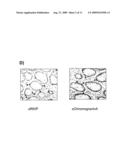 Prediction of Metastasis diagram and image