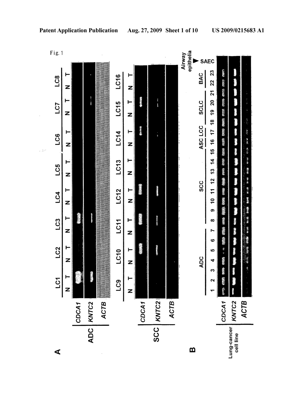 SCREENING AND THERAPEUTIC METHOD FOR NSCLC TARGETING CDCA1-KNTC2 COMPLEX - diagram, schematic, and image 02