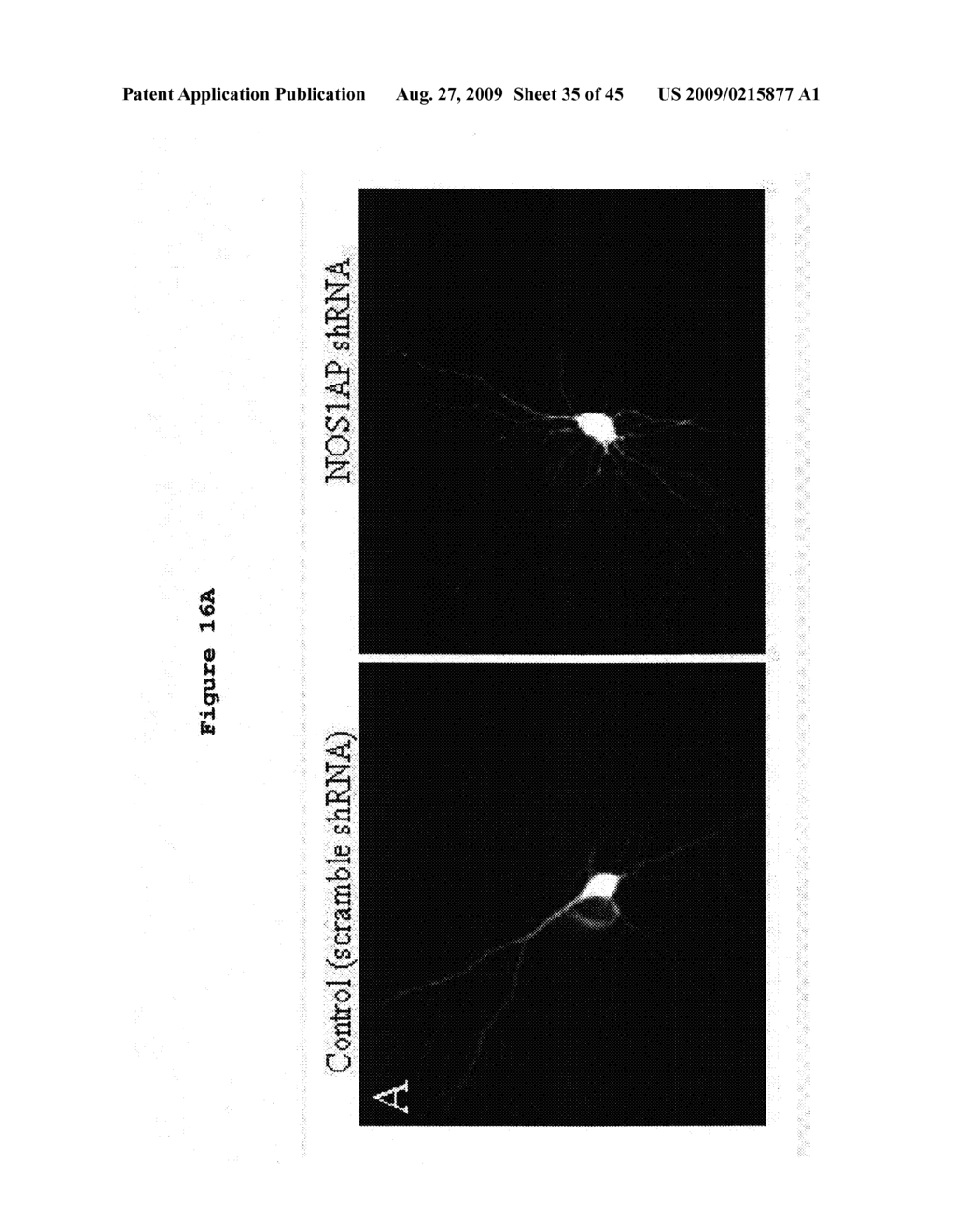 Methods and Compositions for the Diagnosis and Treatment of Schizophrenia - diagram, schematic, and image 36