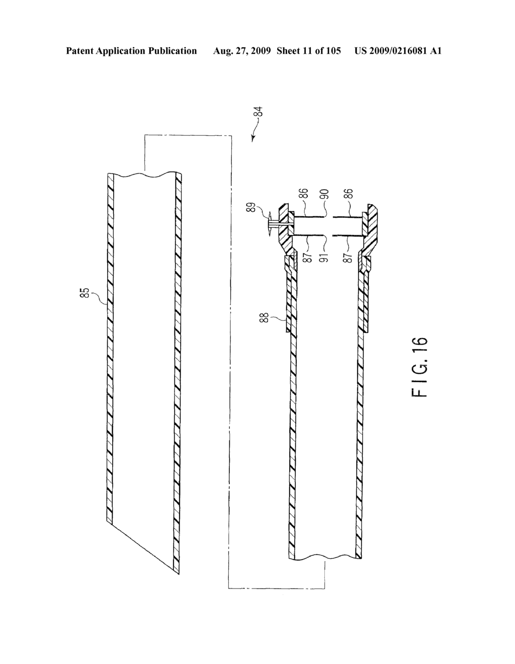 ANASTOMOSIS SYSTEM - diagram, schematic, and image 12