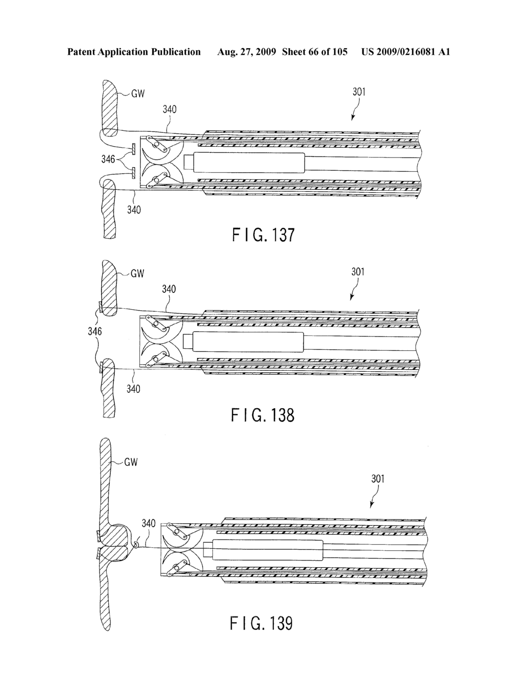 ANASTOMOSIS SYSTEM - diagram, schematic, and image 67