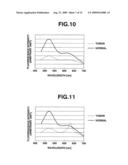 FLUORESCENT ENDOSCOPIC DEVICE AND METHOD OF CREATING FLUORESCENT ENDOSCOPIC IMAGE diagram and image