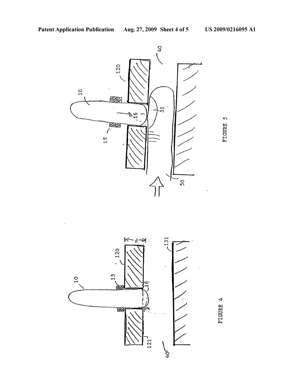 Arrangement for Providing a Constant Contract Pressure for a Probe - diagram, schematic, and image 05