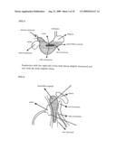 NOVEL METHOD OF USING TRIACETIN AND AUXILIARY AGENT FOR ULTRASONIC DIAGNOSTIC EXAMINATION diagram and image