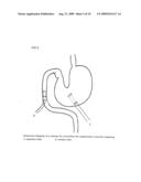 NOVEL METHOD OF USING TRIACETIN AND AUXILIARY AGENT FOR ULTRASONIC DIAGNOSTIC EXAMINATION diagram and image