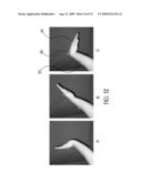 METHOD OF ASSESSING LOCALIZED SHAPE AND TEMPERATURE OF THE HUMAN BODY diagram and image