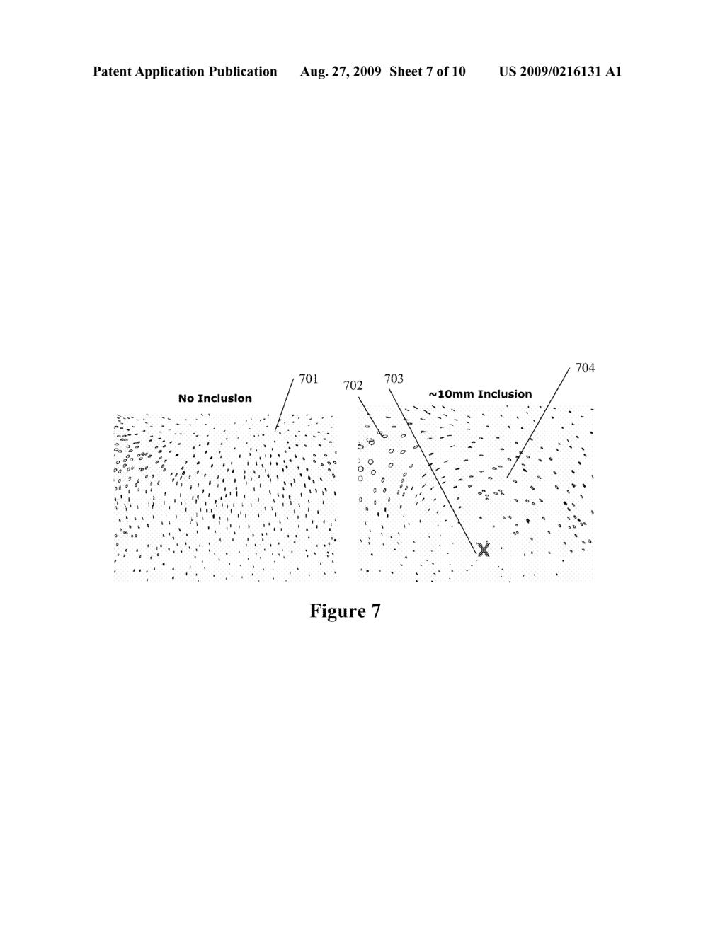 USE OF SURFACE MOTION TO IDENTIFY MECHANICAL PROPERTIES OF BIOLOGICAL TISSUE - diagram, schematic, and image 08