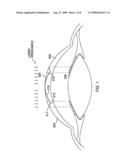 METHOD AND SYSTEMS FOR LASER TREATMENT OF PRESBYOPIA USING OFFSET IMAGING diagram and image