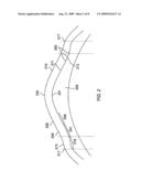 METHOD AND SYSTEMS FOR LASER TREATMENT OF PRESBYOPIA USING OFFSET IMAGING diagram and image