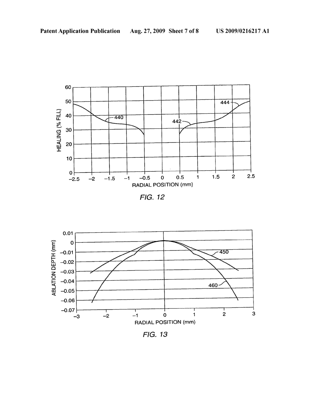 METHOD AND SYSTEMS FOR LASER TREATMENT OF PRESBYOPIA USING OFFSET IMAGING - diagram, schematic, and image 08