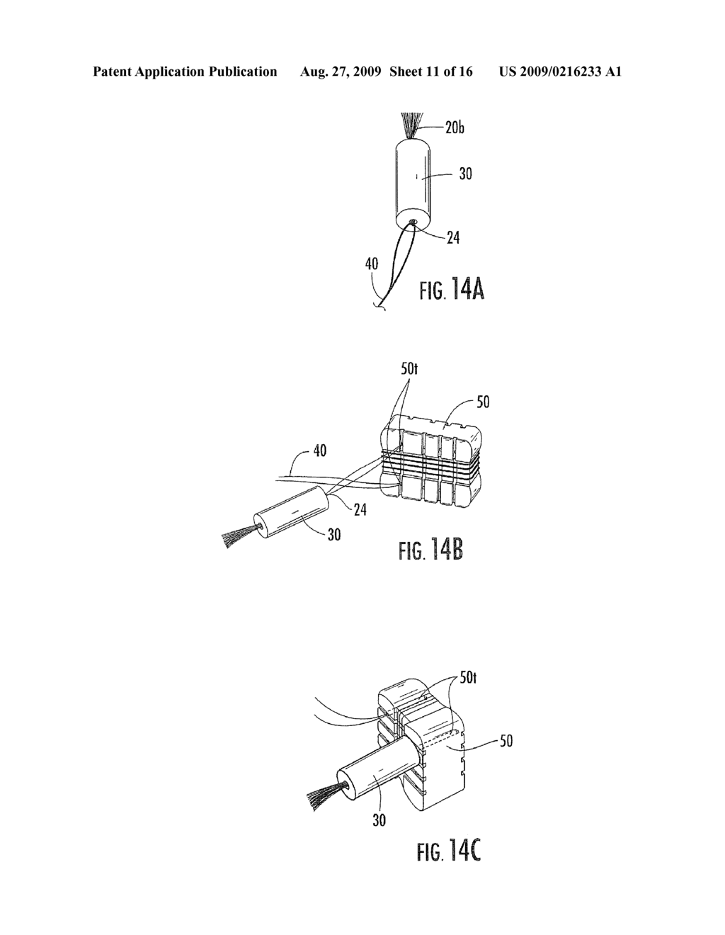 BIOSTAPLES SUITABLE FOR WRIST, HAND AND OTHER LIGAMENT REPLACEMENTS OR REPAIRS - diagram, schematic, and image 12