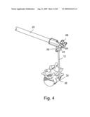 Spinal Access Systems and Methods diagram and image