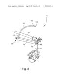 Spinal Access Systems and Methods diagram and image