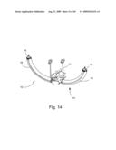 Spinal Access Systems and Methods diagram and image