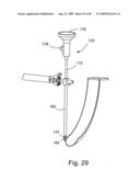 Spinal Access Systems and Methods diagram and image