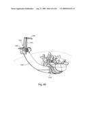 Spinal Access Systems and Methods diagram and image