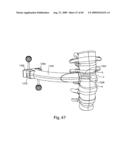 Spinal Access Systems and Methods diagram and image