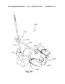 Spinal Access Systems and Methods diagram and image