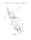 Spinal Access Systems and Methods diagram and image