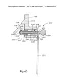 Spinal Access Systems and Methods diagram and image