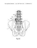 Spinal Access Systems and Methods diagram and image