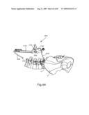 Spinal Access Systems and Methods diagram and image