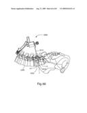 Spinal Access Systems and Methods diagram and image