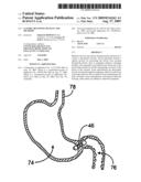 GASTRIC RETAINING DEVICES AND METHODS diagram and image