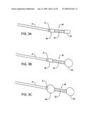 GASTRIC RETAINING DEVICES AND METHODS diagram and image