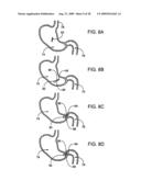 GASTRIC RETAINING DEVICES AND METHODS diagram and image