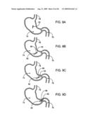 GASTRIC RETAINING DEVICES AND METHODS diagram and image