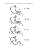 GASTRIC RETAINING DEVICES AND METHODS diagram and image