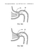 GASTRIC RETAINING DEVICES AND METHODS diagram and image