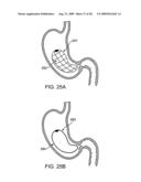 GASTRIC RETAINING DEVICES AND METHODS diagram and image